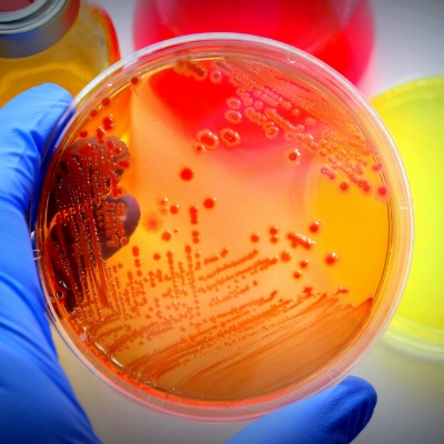 escherichia coli